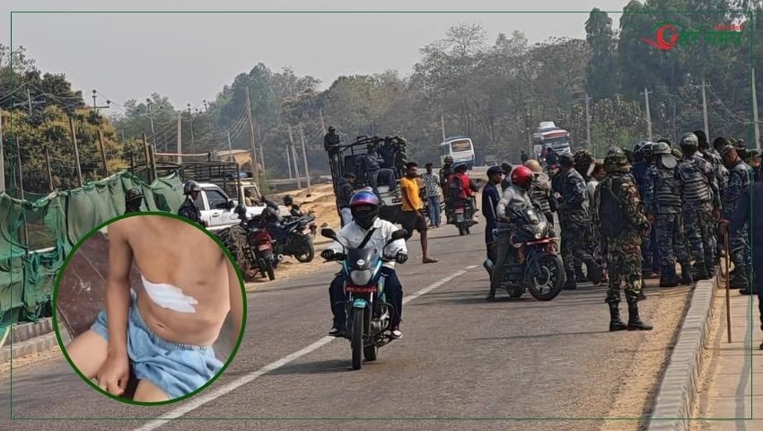 धनुषामा विस्फोटक पदार्थ पड्किँदा दुई बालबालिका घाइते