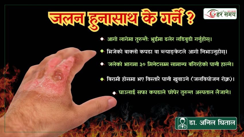 जलन हुनासाथ के गर्ने ? के भन्छन् रिजनल अपरेसन म्यानेजर डा. अनिल धिताल ?
