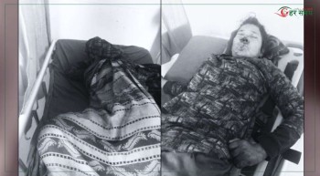 देउरानीले बाउसो प्रहारबाट घाइते जेठानीको मृत्यु