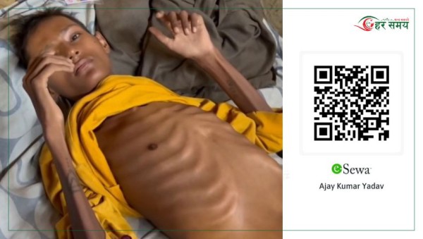 झुपडीमा मृत्युसँग लडिरहेका विजय : जो गरिबीका कारण उपचारबाट बन्चित छन्
