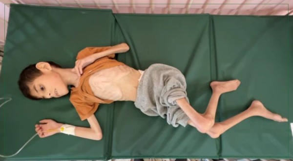 भोकभोकै मर्दै गाजाका बालबालिका, इजरायली नाकाबन्दीले ३५ सय मृत्युको मुखमा