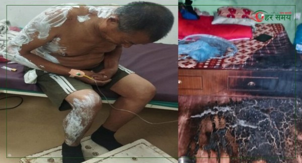 सिन्धुलीको धुराबजारमा घरको भान्सामा आगो लाग्दा बुहारीको मृत्यु, ससुरा घाइते