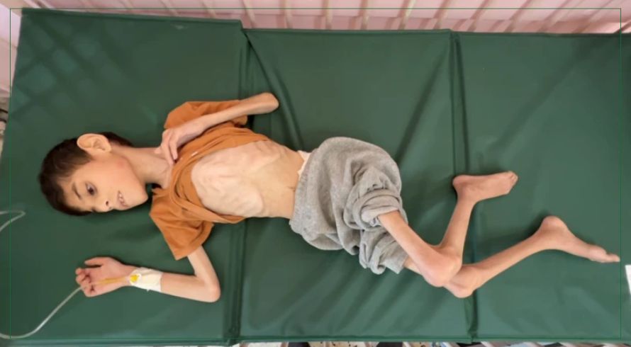 भोकभोकै मर्दै गाजाका बालबालिका, इजरायली नाकाबन्दीले ३५ सय मृत्युको मुखमा