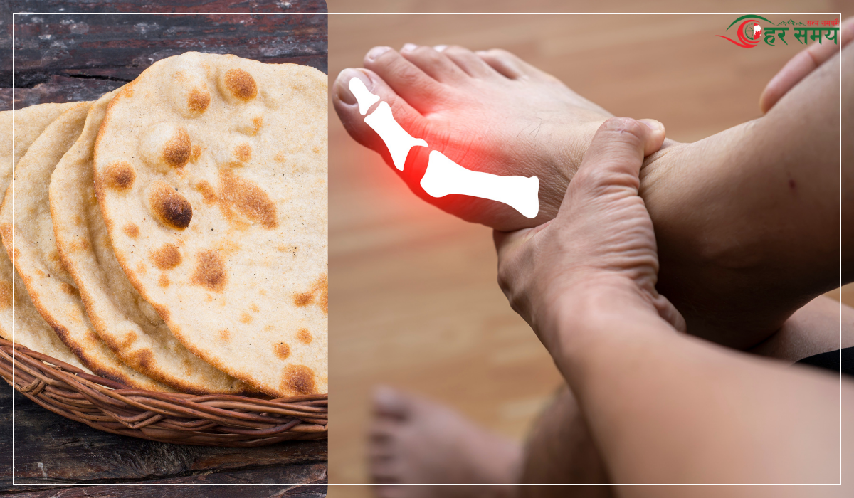 युरिक एसिड घटाउने हाे भने राेटीमा यी चीज मिसाउनुहाेस्